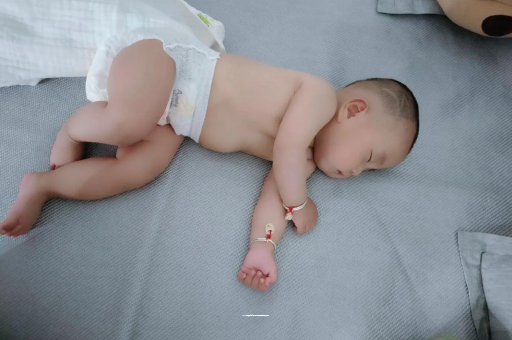灌云宝宝头上长痱子